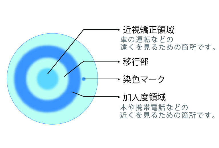 多焦点ソフトコンタクトレンズの概要